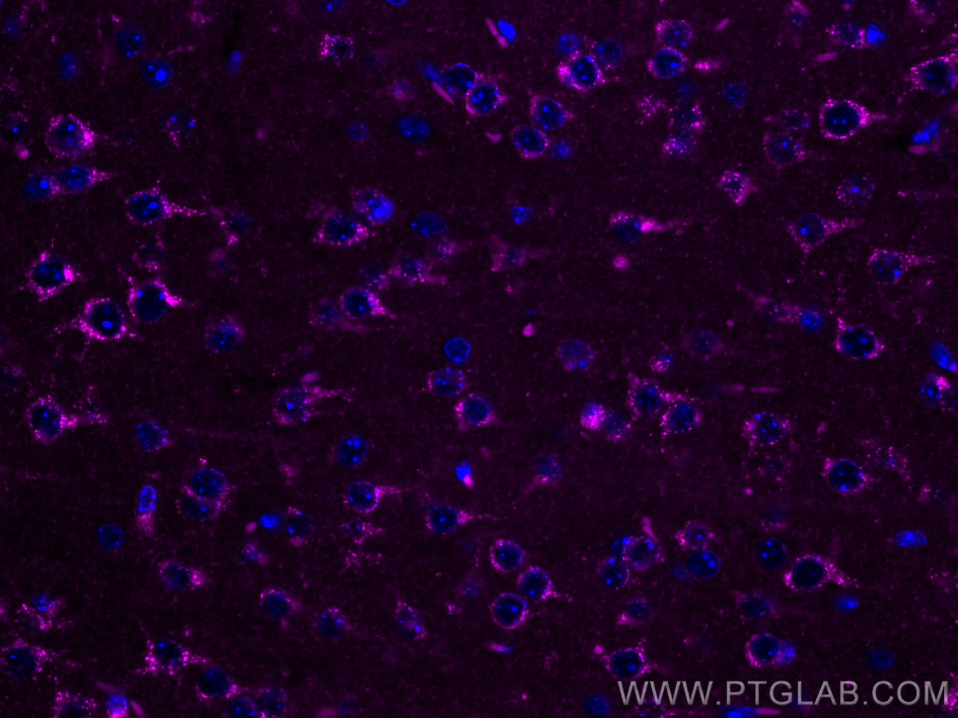 Immunofluorescence (IF) / fluorescent staining of mouse brain tissue using CoraLite® Plus 647-conjugated Sortilin Polyclonal  (CL647-12369)
