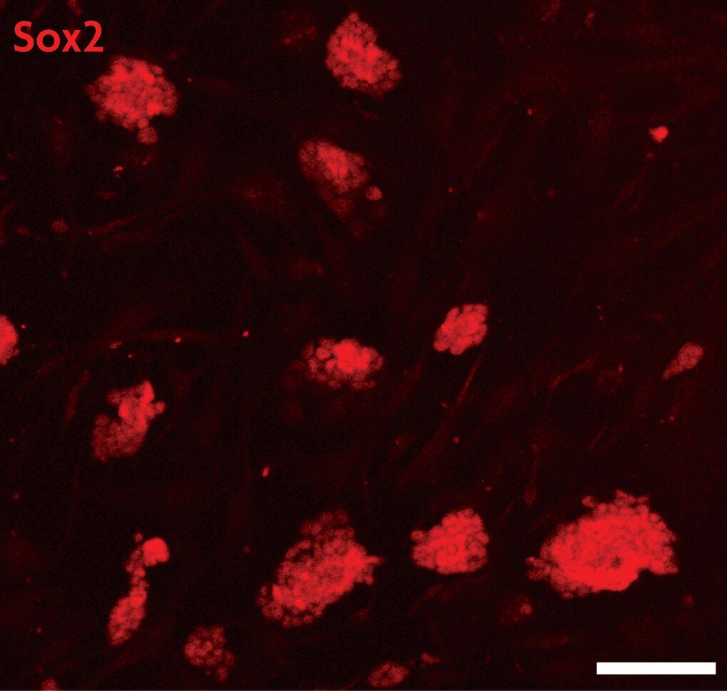 Sox2 antibody (pAb) tested by Immunofluorescence. Mouse embryonic stem cells (mESCs) grown on mouse embryonic fibroblast feeder cells (MEFs) were fixed with 4% paraformaldehyde for 10 minutes at room temperature. Cells were then permeabilized and blocked by incubating with Blocking Solution containing 5% serum/0.1% Triton X-100 in D-PBS for 2 hours at room temperature. Cells were then incubated with Sox2 antibody (Catalog No. 39843, red) at 1:200 dilution overnight at 4°C, washed with D-PBS, and incubated for 2 hours at room temperature with goat anti-mouse Cy3 secondary antibody at 1:250 dilution. Cells were visualized using a Zeiss fluorescent microscope at 20X magnification. Images show that Sox2 antibody specifically stains mESC colonies and does not stain MEFs. Absence of Sox2 staining in a subset of cells within the colonies suggests differentiation. Scale bars, 100 μm.