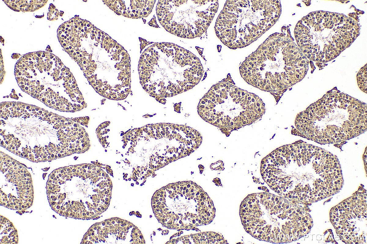 IHC staining of mouse testis using 30287-1-AP