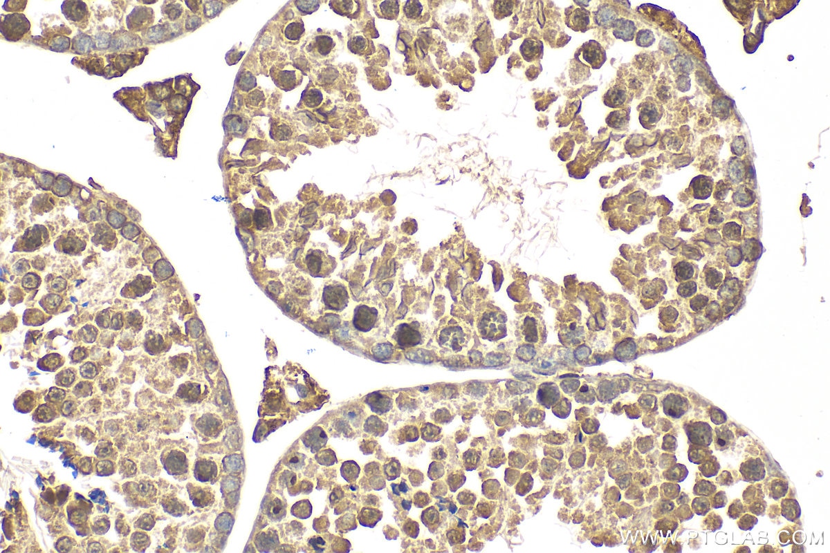 Immunohistochemistry (IHC) staining of mouse testis tissue using Spag8 Polyclonal antibody (30287-1-AP)