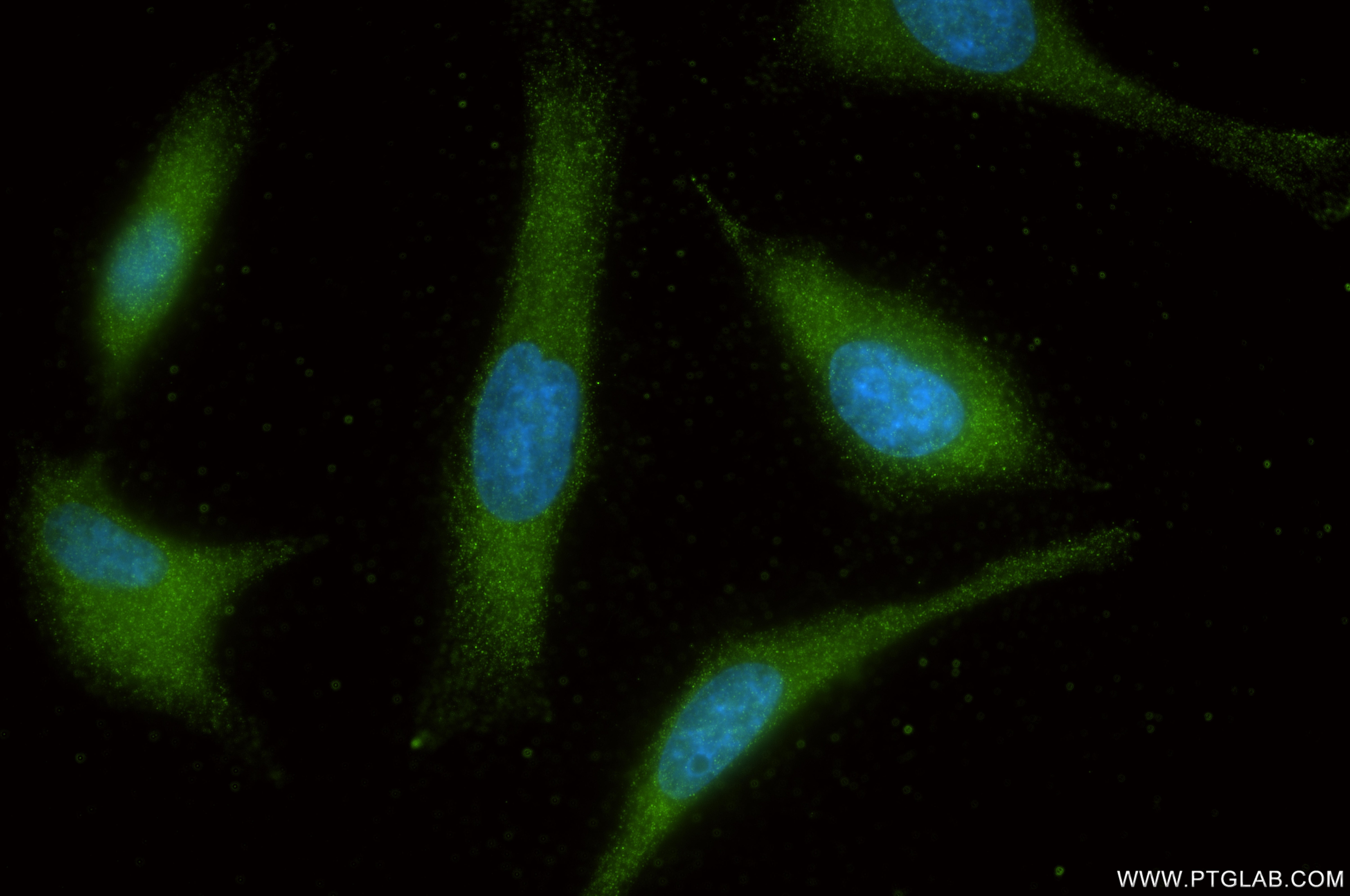 Immunofluorescence (IF) / fluorescent staining of HeLa cells using Spartin/SPG20 Recombinant monoclonal antibody (85938-2-RR)