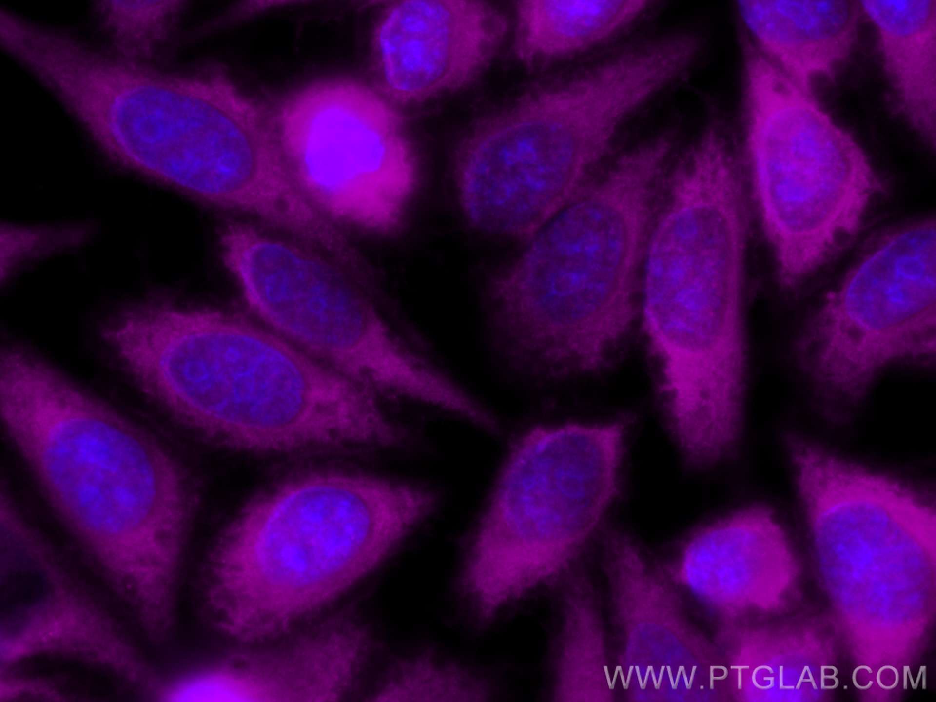 Immunofluorescence (IF) / fluorescent staining of HepG2 cells using CoraLite® Plus 647-conjugated Spartin, SPG20 Polyc (CL647-13791)