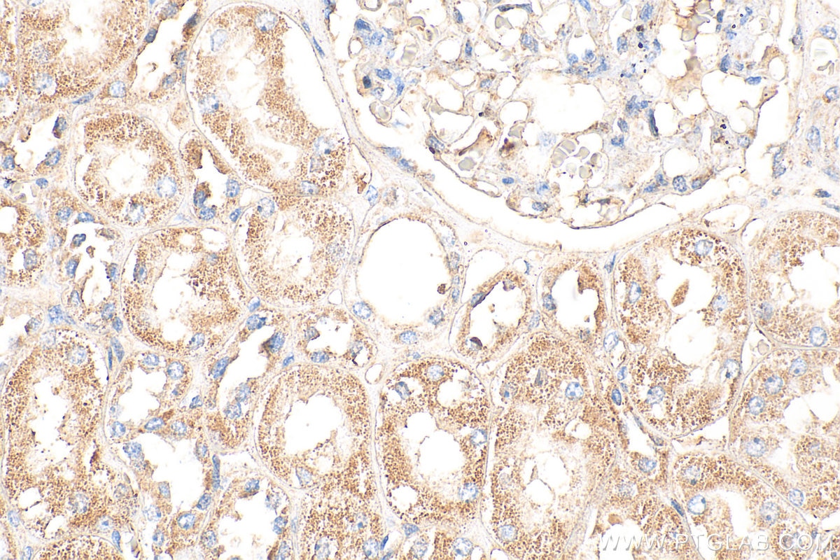 Immunohistochemistry (IHC) staining of human kidney tissue using Spexin Polyclonal antibody (20467-1-AP)