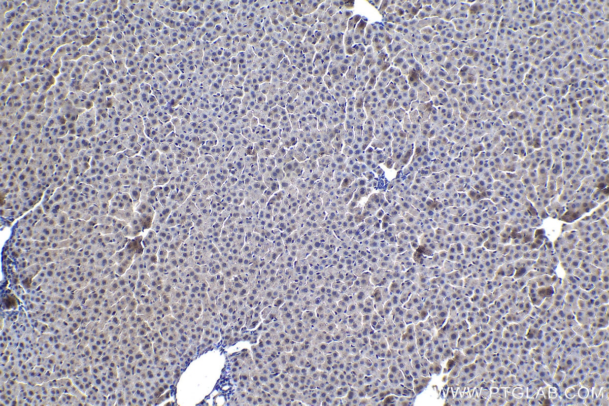 IHC staining of rat liver using 20663-1-AP (same clone as 20663-1-PBS) Immunohistochemistry (IHC) staining of rat liver tissue using Stabilin-1 Polyclonal antibody (20663-1-AP)