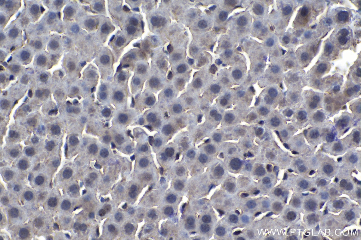 IHC staining of rat liver using 20663-1-AP (same clone as 20663-1-PBS) Immunohistochemistry (IHC) staining of rat liver tissue using Stabilin-1 Polyclonal antibody (20663-1-AP)