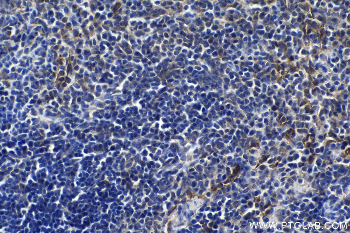 IHC staining of mouse spleen using 20663-1-AP (same clone as 20663-1-PBS) Immunohistochemistry (IHC) staining of mouse spleen tissue using Stabilin-1 Polyclonal antibody (20663-1-AP)