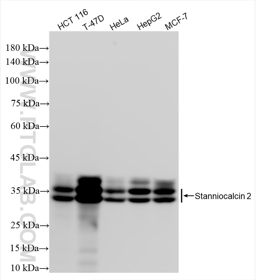 Stanniocalcin 2