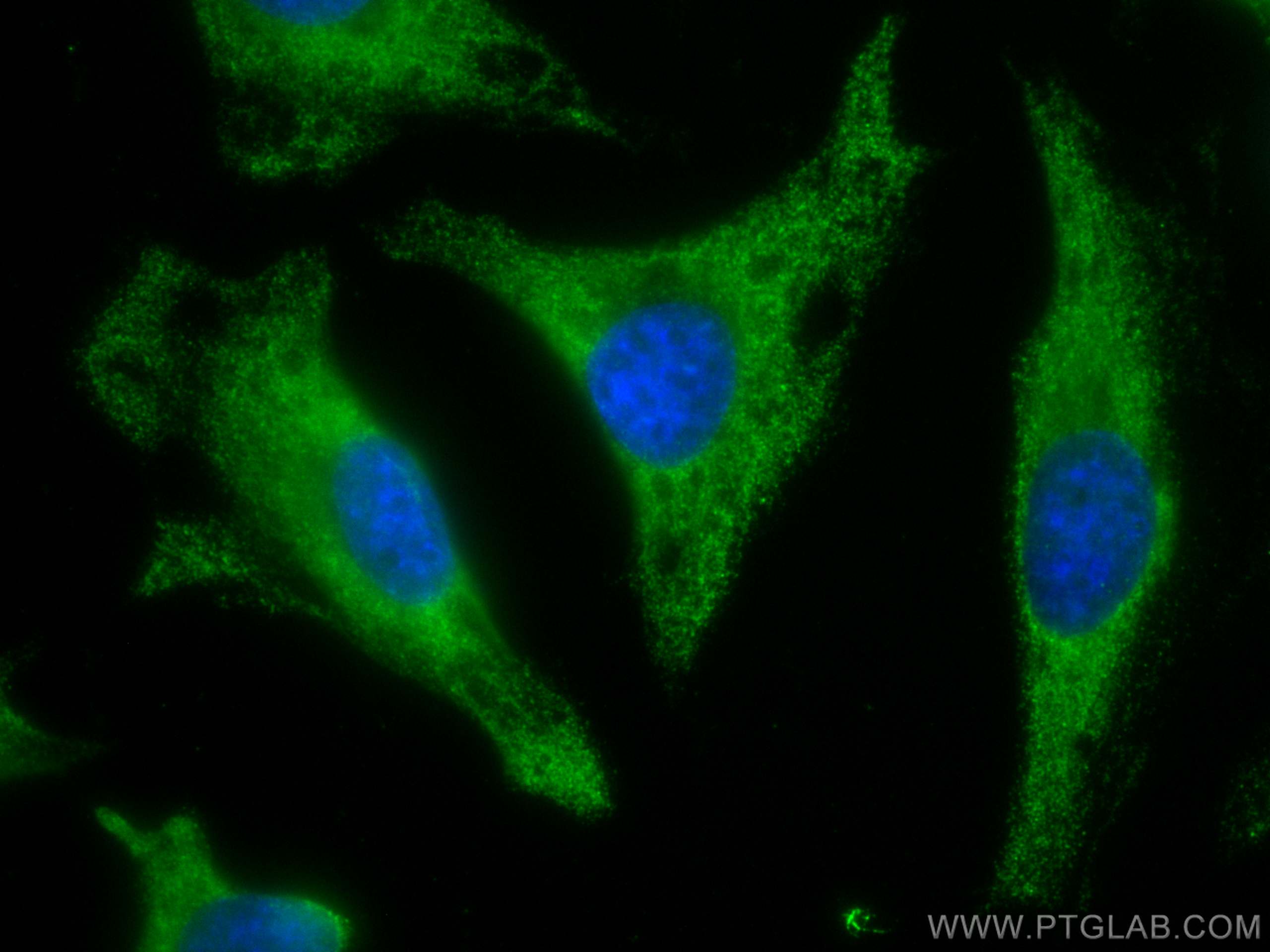 Immunofluorescence (IF) / fluorescent staining of HeLa cells using CoraLite® Plus 488-conjugated Stanniocalcin 2 Mono (CL488-60063)