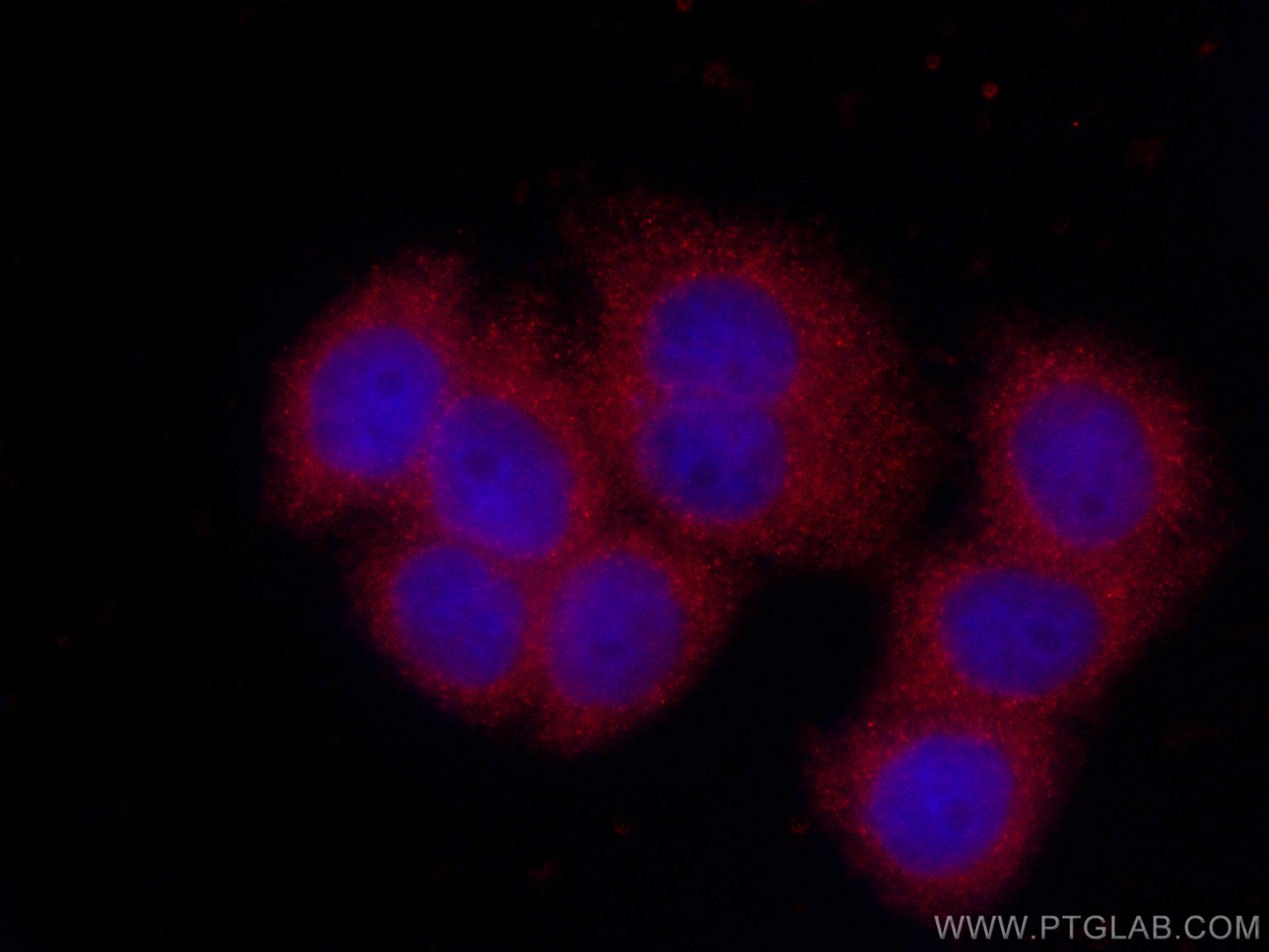 Immunofluorescence (IF) / fluorescent staining of HeLa cells using CoraLite®594-conjugated Stanniocalcin 2 Monoclonal (CL594-60063)