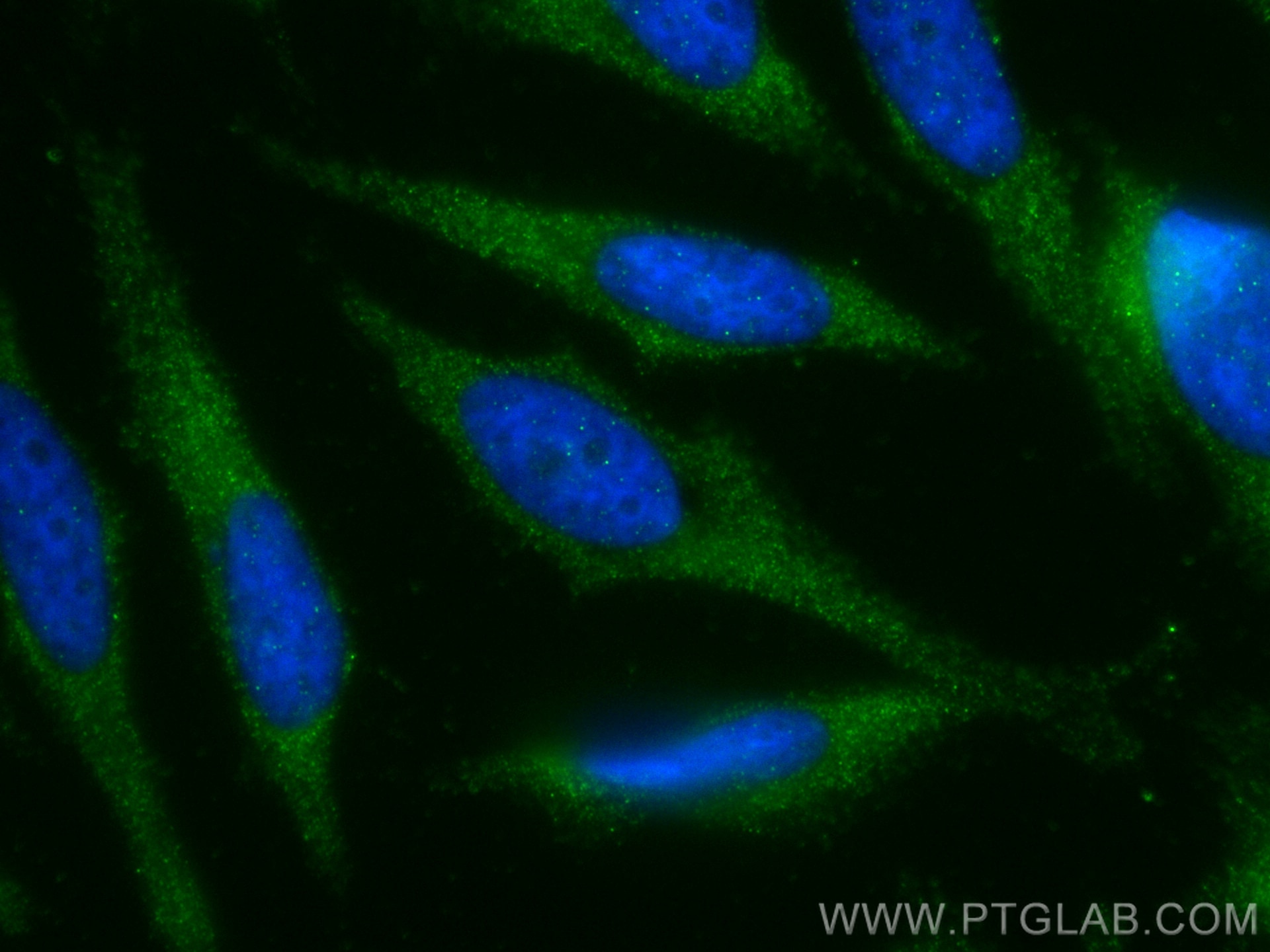Immunofluorescence (IF) / fluorescent staining of HeLa cells using Stathmin 1 Recombinant antibody (82559-1-RR)