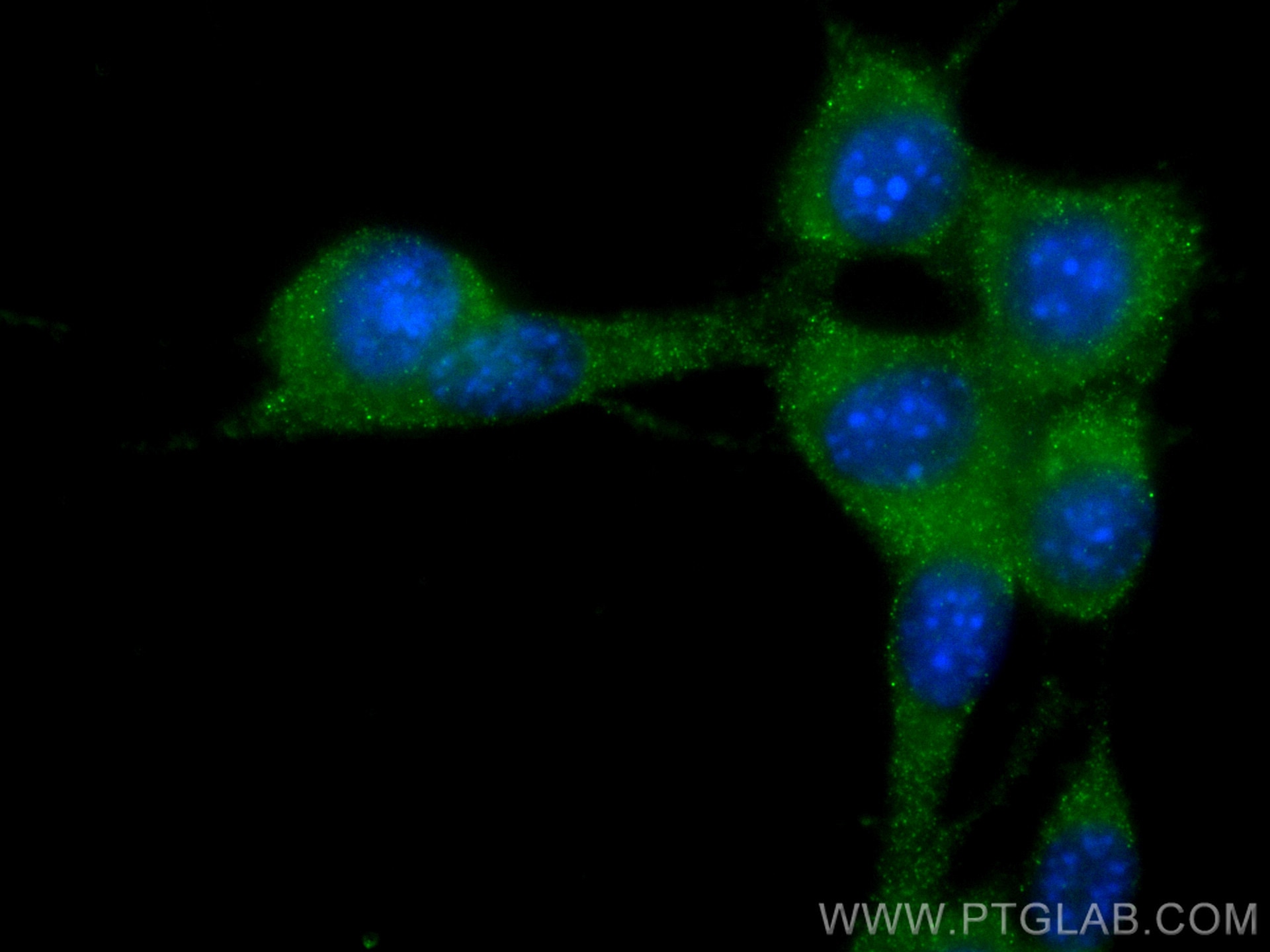 Immunofluorescence (IF) / fluorescent staining of NIH/3T3 cells using Stathmin 1 Recombinant antibody (82559-1-RR)