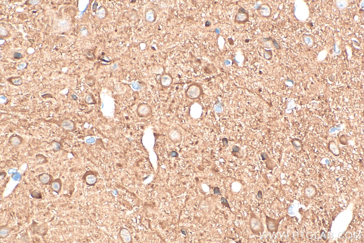 IHC staining of rat brain using 82559-1-RR