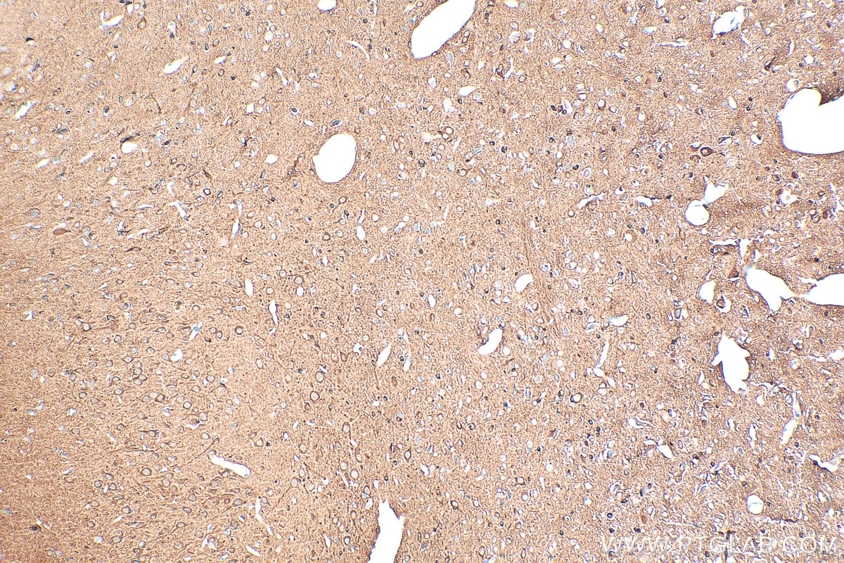 Immunohistochemistry (IHC) staining of rat brain tissue using Stathmin 1 Recombinant antibody (82559-1-RR)