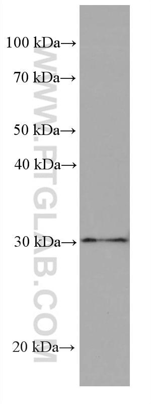 Western Blot (WB) analysis of human peripheral blood platelets using Stomatin Monoclonal antibody (67894-1-Ig)