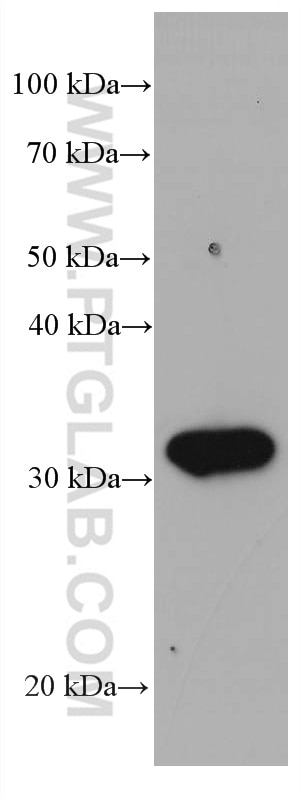 Western Blot (WB) analysis of human placenta tissue using Stomatin Monoclonal antibody (67894-1-Ig)