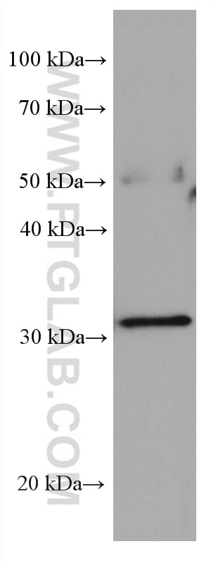 Western Blot (WB) analysis of human testis tissue using Stomatin Monoclonal antibody (67894-1-Ig)