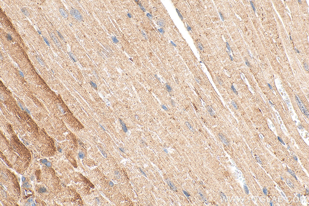 Immunohistochemistry (IHC) staining of mouse heart tissue using Supervillin Polyclonal antibody (27524-1-AP)