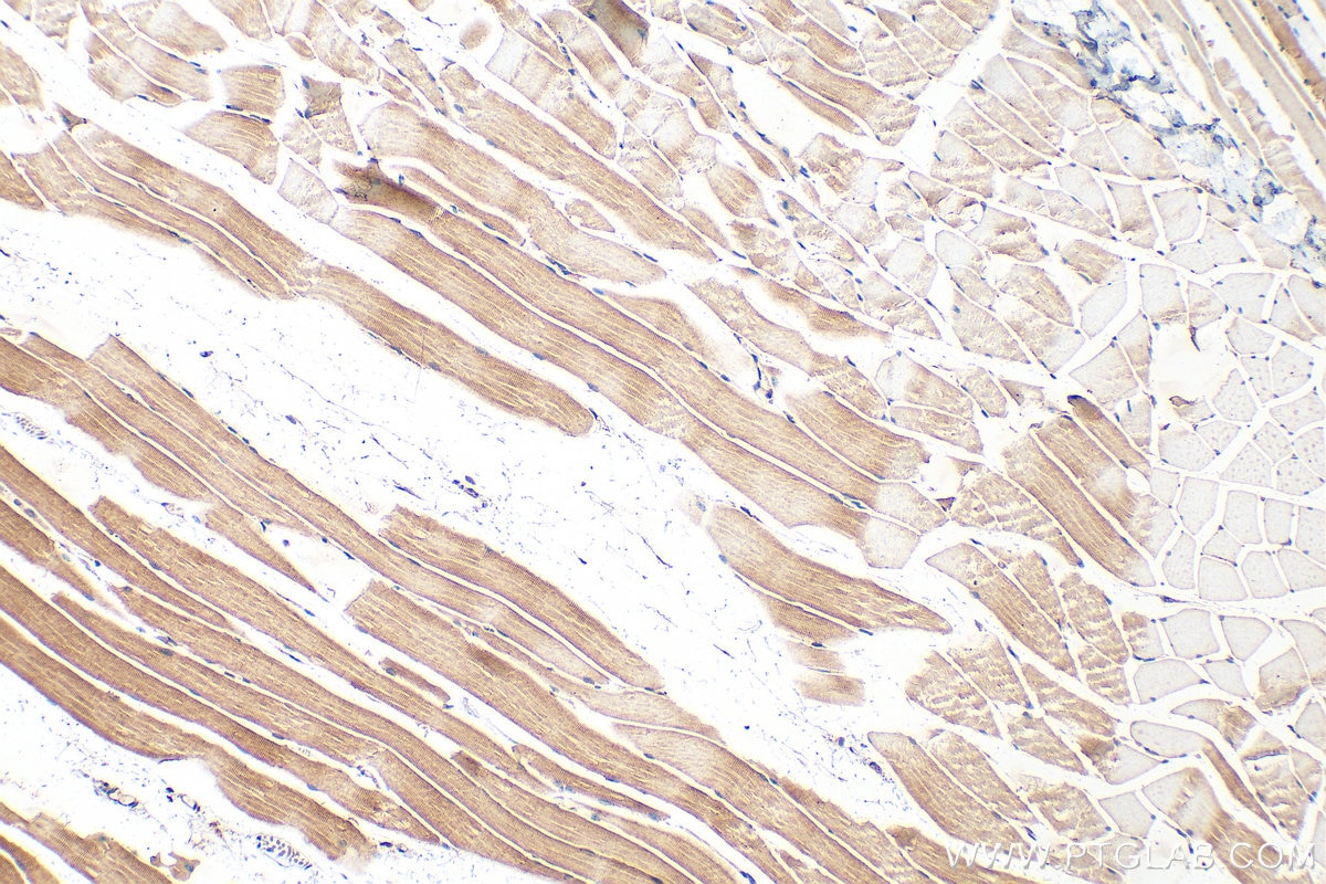 Immunohistochemistry (IHC) staining of mouse skeletal muscle tissue using Supervillin Polyclonal antibody (27524-1-AP)