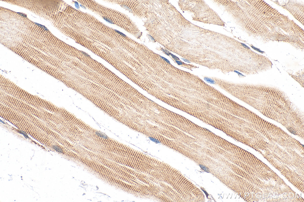 Immunohistochemistry (IHC) staining of mouse skeletal muscle tissue using Supervillin Polyclonal antibody (27524-1-AP)