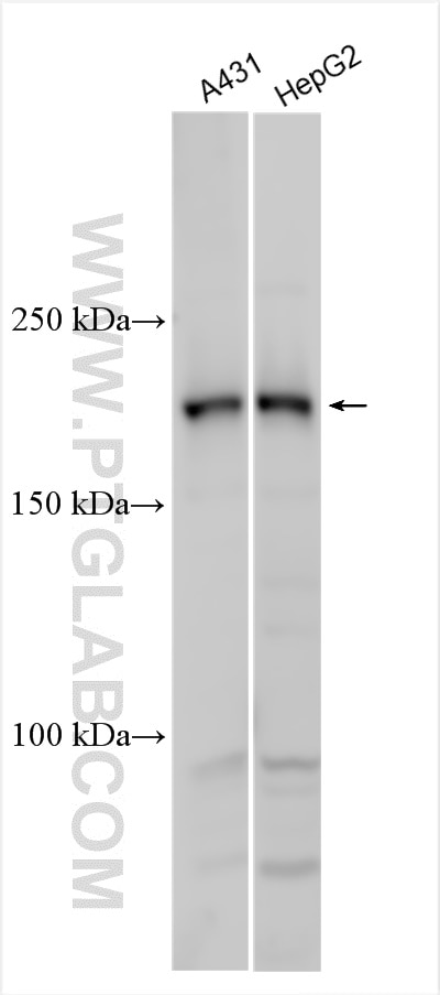 Western Blot (WB) analysis of various lysates using Supervillin Polyclonal antibody (27524-1-AP)