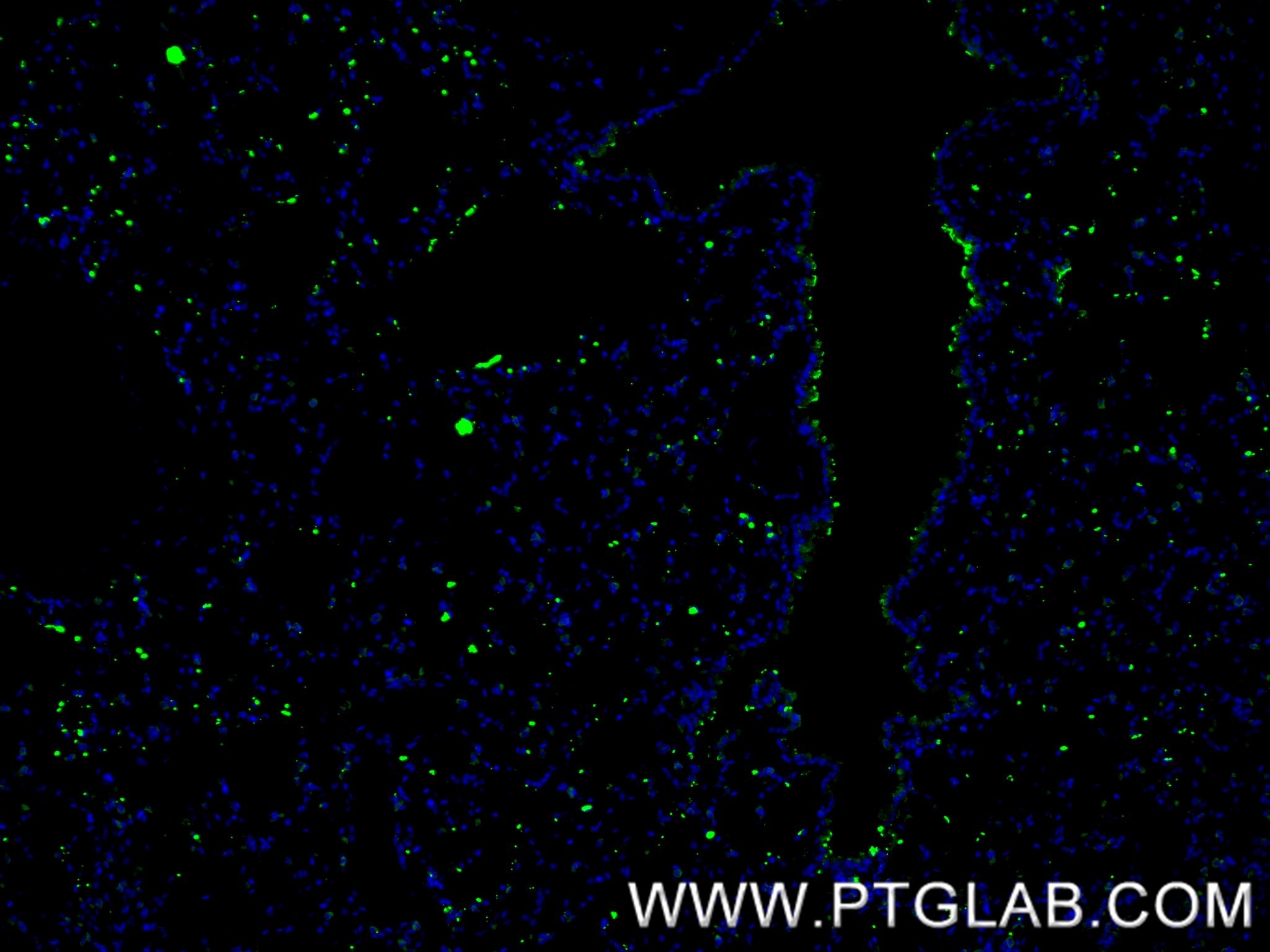 IF Staining of mouse lung using 86322-1-RR Immunofluorescence (IF) / fluorescent staining of mouse lung tissue using Surfactant Protein A Recombinant monoclonal antibo (86322-1-RR)