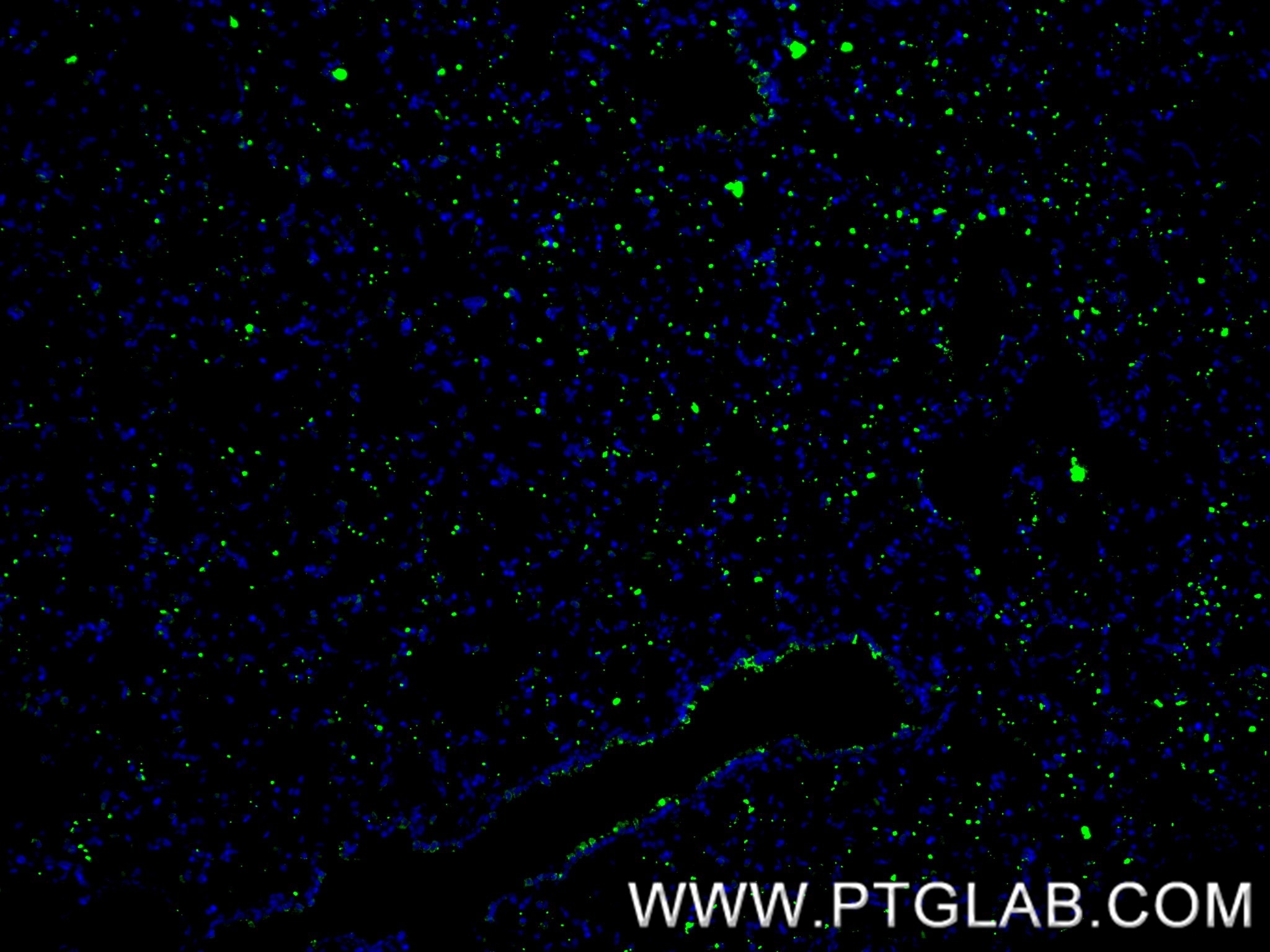 IF Staining of rat lung using 86322-1-RR Immunofluorescence (IF) / fluorescent staining of rat lung tissue using Surfactant Protein A Recombinant monoclonal antibo (86322-1-RR)
