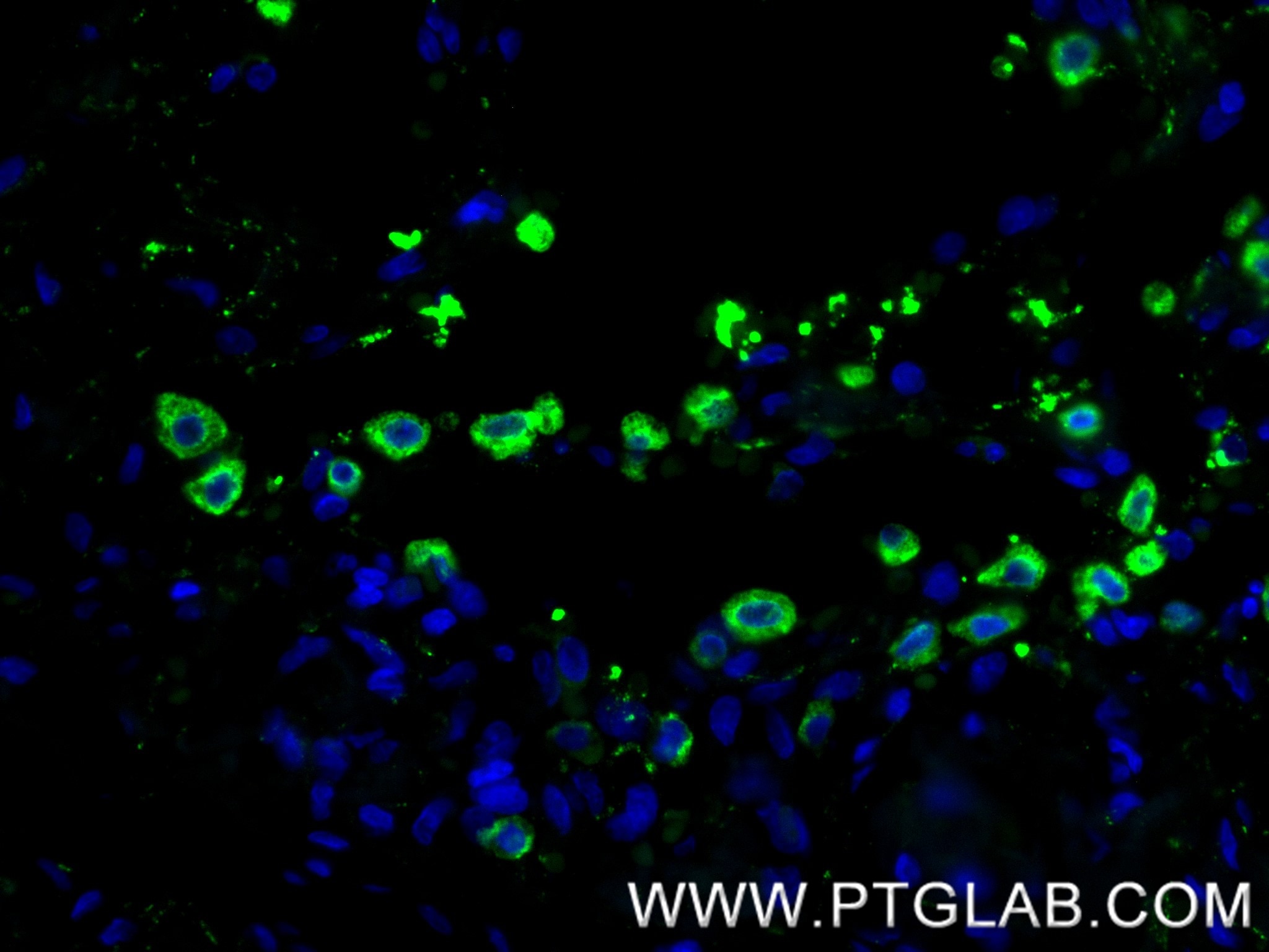 IF Staining of human lung using 86322-1-RR Immunofluorescence (IF) / fluorescent staining of human lung tissue using Surfactant Protein A Recombinant monoclonal antibo (86322-1-RR)