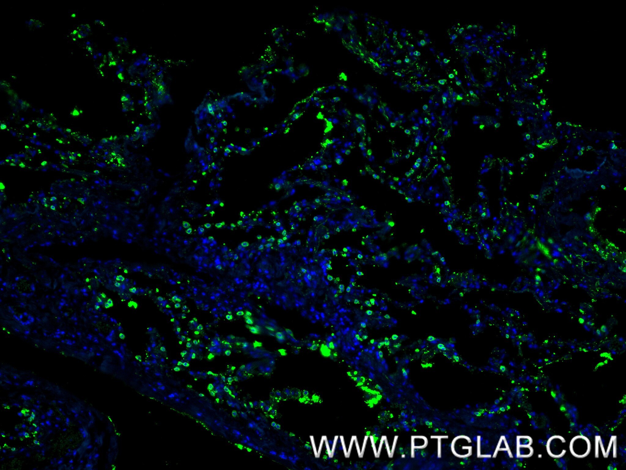 IF Staining of human lung using 86322-1-RR Immunofluorescence (IF) / fluorescent staining of human lung tissue using Surfactant Protein A Recombinant monoclonal antibo (86322-1-RR)