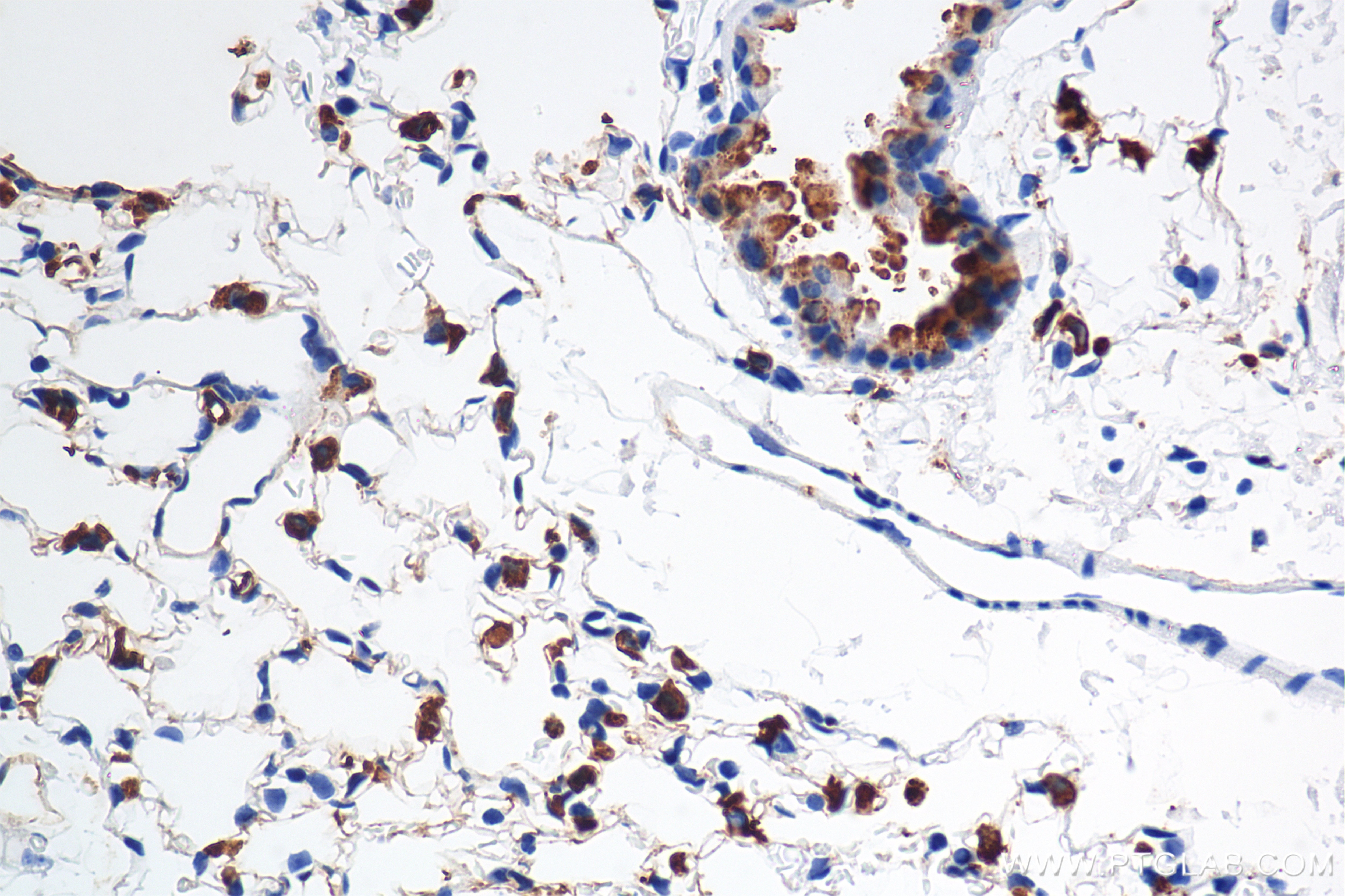 IHC staining of mouse lung using 86322-1-RR Immunohistochemistry (IHC) staining of mouse lung tissue using Surfactant Protein A Recombinant monoclonal antibo (86322-1-RR)