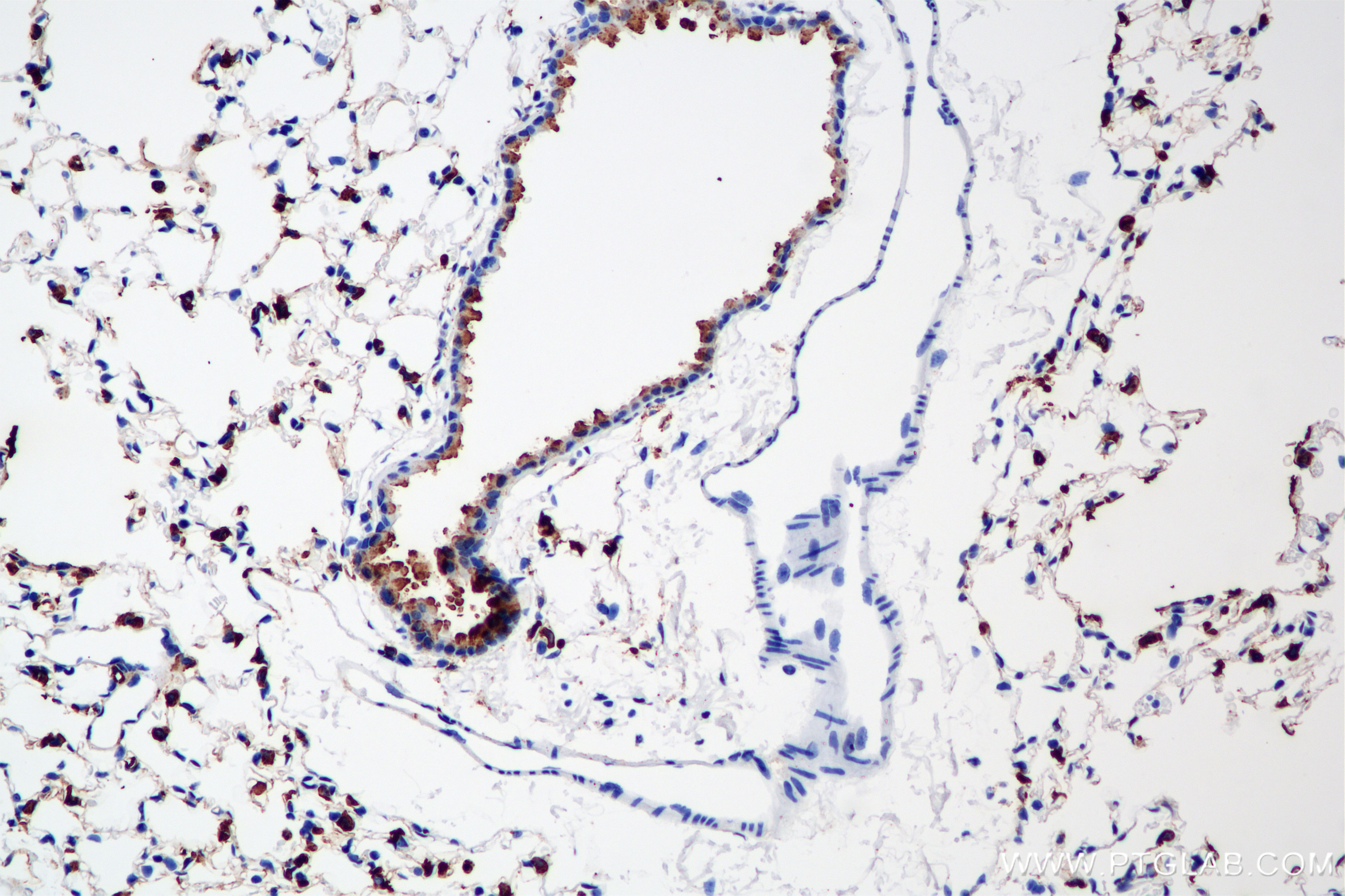 IHC staining of mouse lung using 86322-1-RR Immunohistochemistry (IHC) staining of mouse lung tissue using Surfactant Protein A Recombinant monoclonal antibo (86322-1-RR)