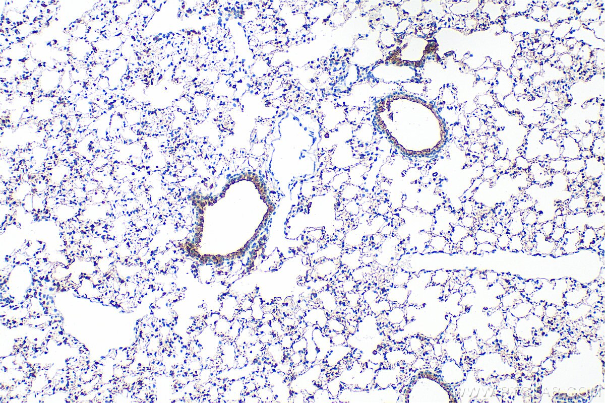 Immunohistochemistry (IHC) staining of mouse lung tissue using Surfactant protein D Polyclonal antibody (33001-1-AP)