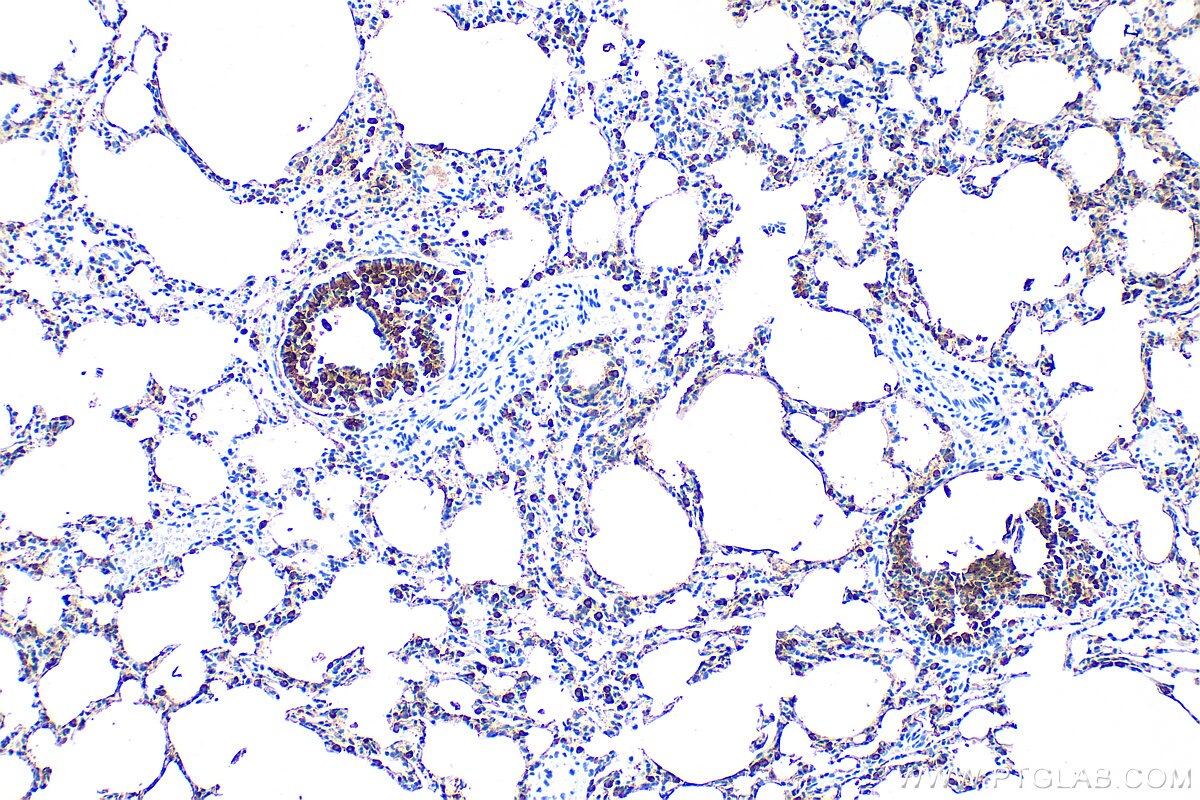 Immunohistochemistry (IHC) staining of rat lung tissue using Surfactant protein D Polyclonal antibody (33001-1-AP)