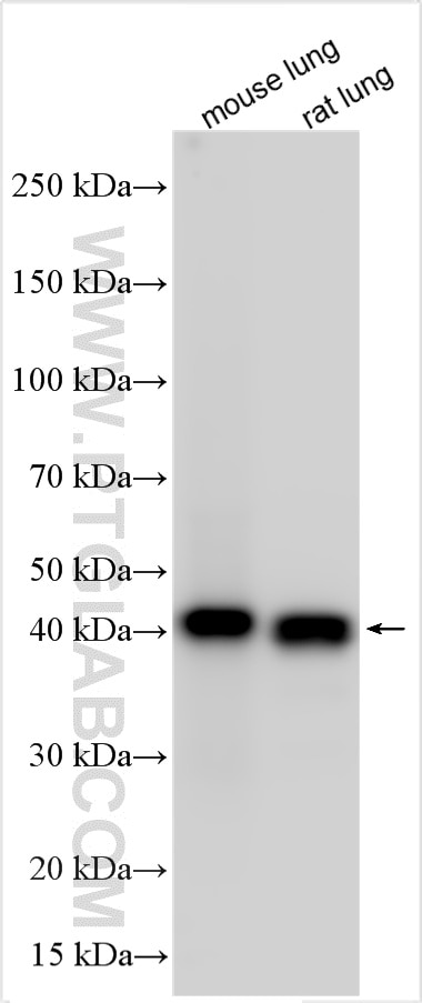 Western Blot (WB) analysis of various lysates using Surfactant protein D Polyclonal antibody (33001-1-AP)