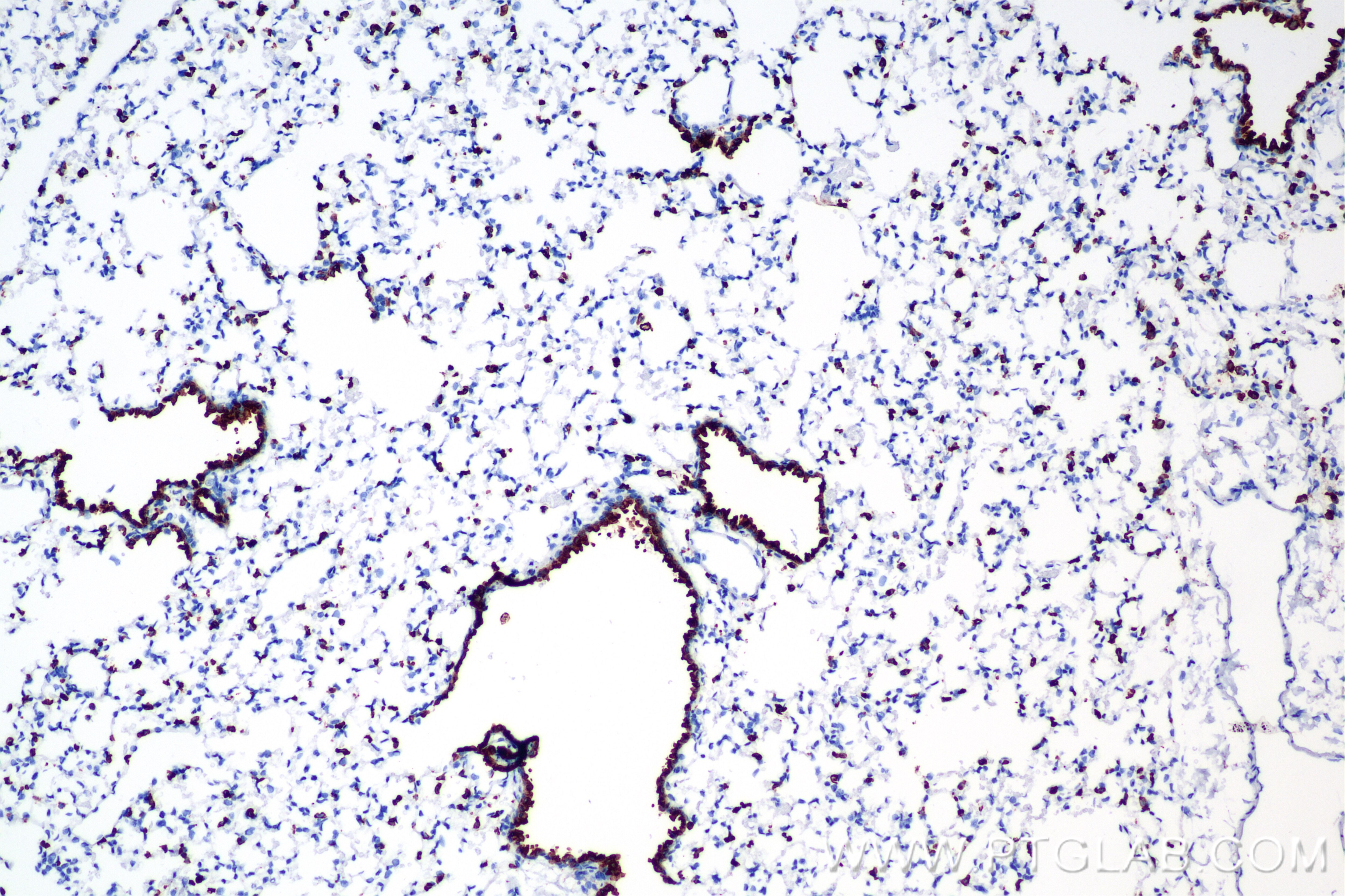 Immunohistochemistry (IHC) staining of rat lung tissue using Surfactant protein D Recombinant antibody (85985-1-RR)