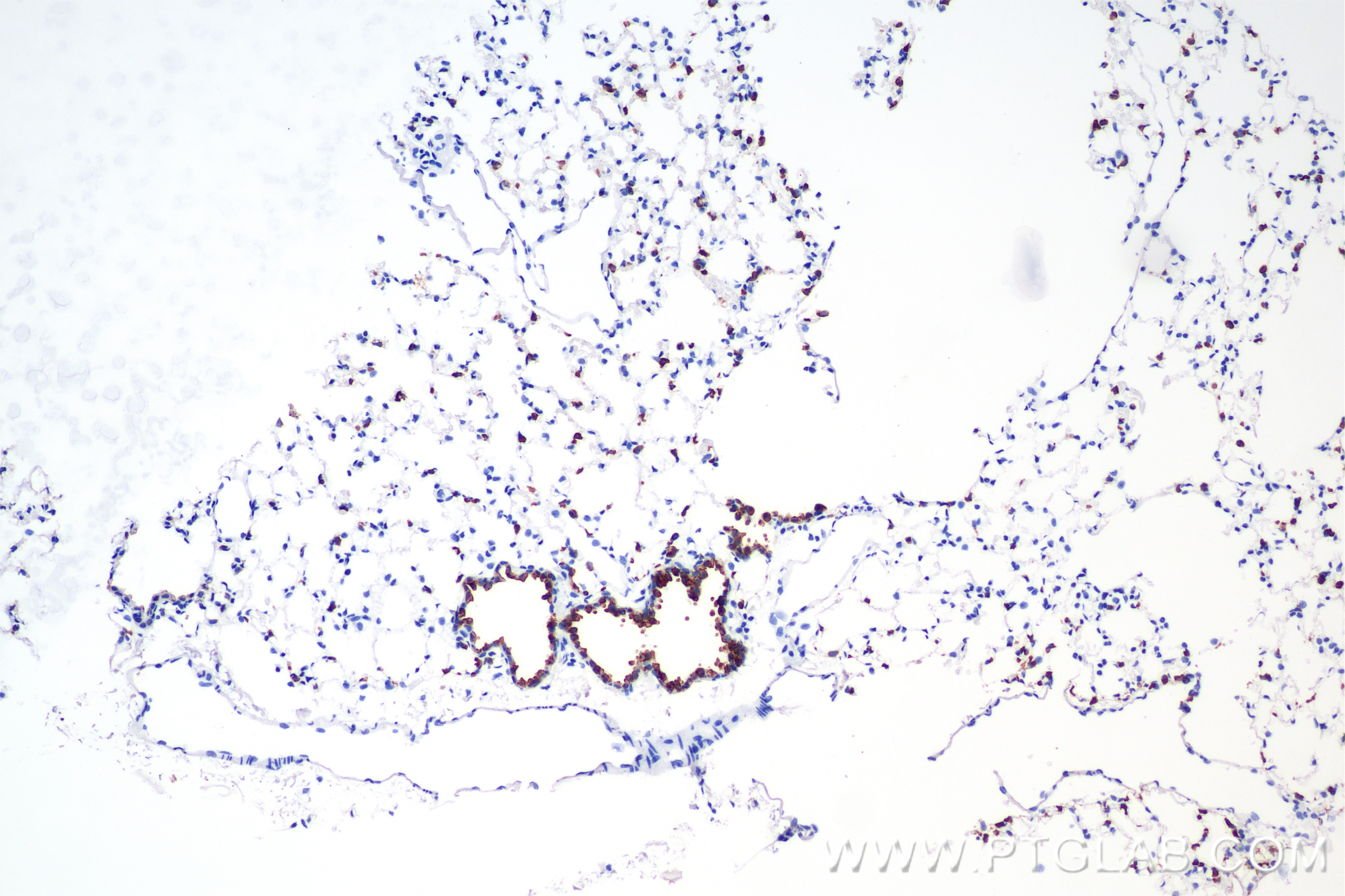 Immunohistochemistry (IHC) staining of mouse lung tissue using Surfactant protein D Recombinant antibody (85985-1-RR)