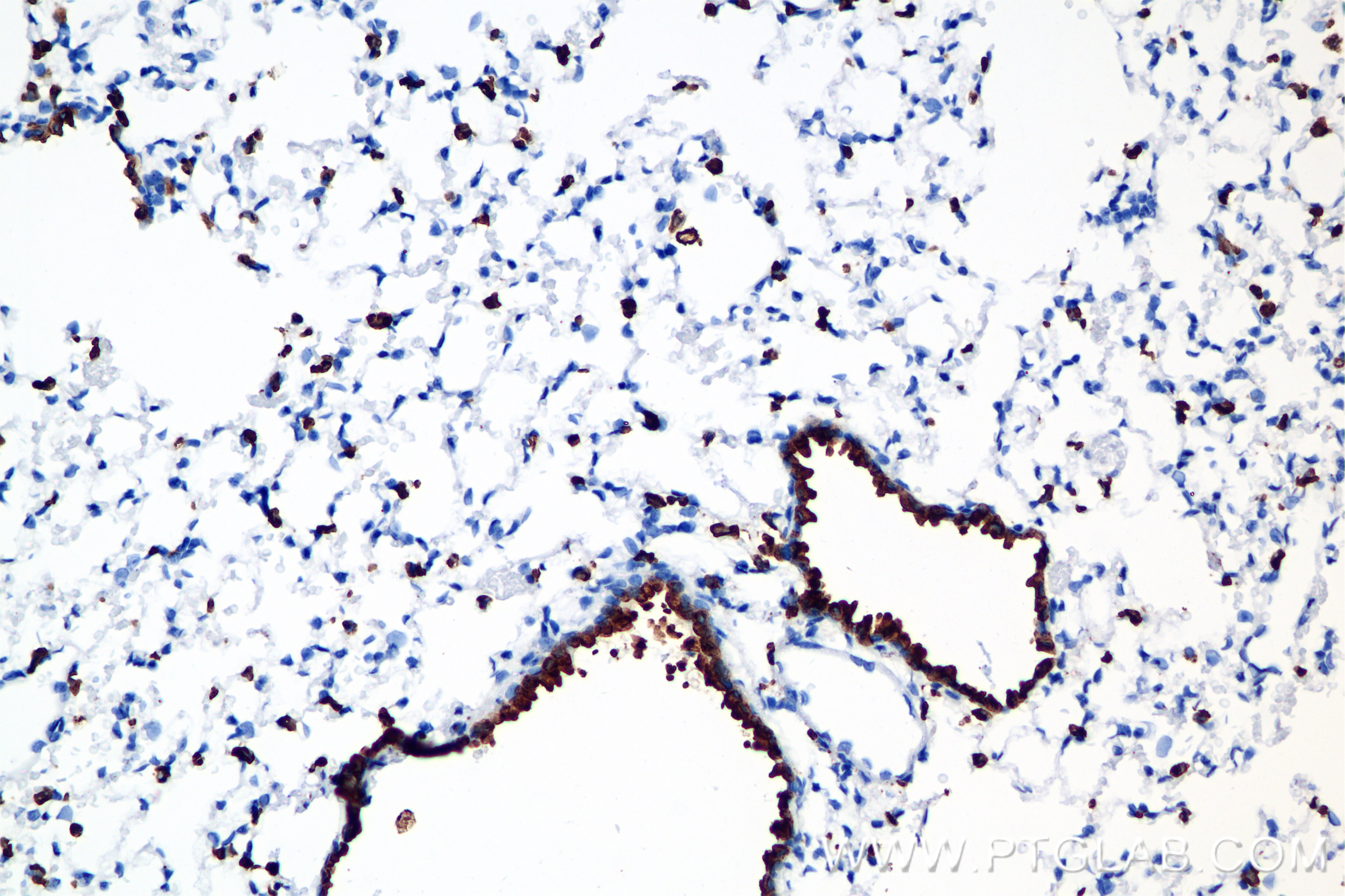 Immunohistochemistry (IHC) staining of rat lung tissue using Surfactant protein D Recombinant antibody (85985-1-RR)