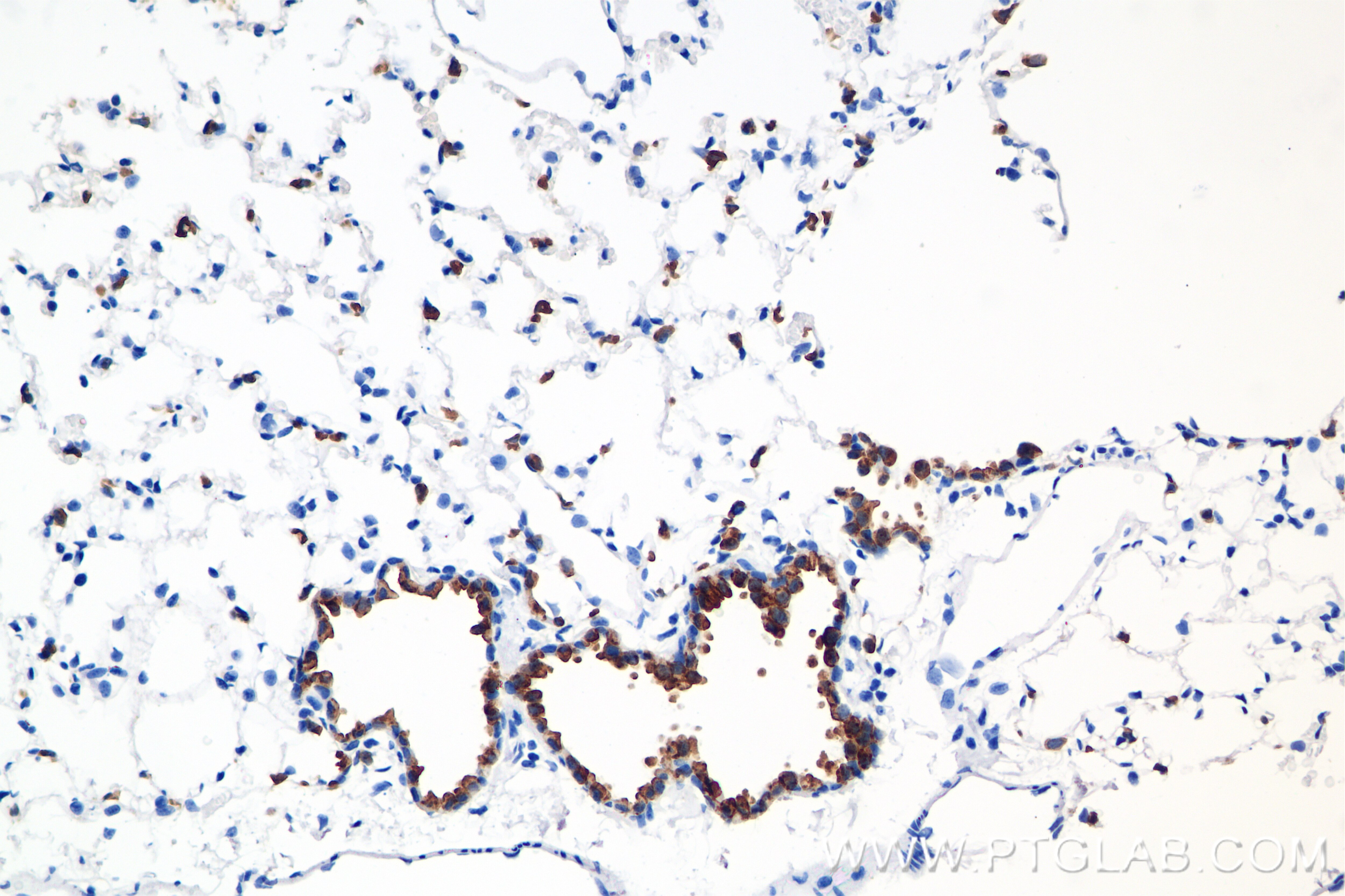 Immunohistochemistry (IHC) staining of mouse lung tissue using Surfactant protein D Recombinant antibody (85985-1-RR)