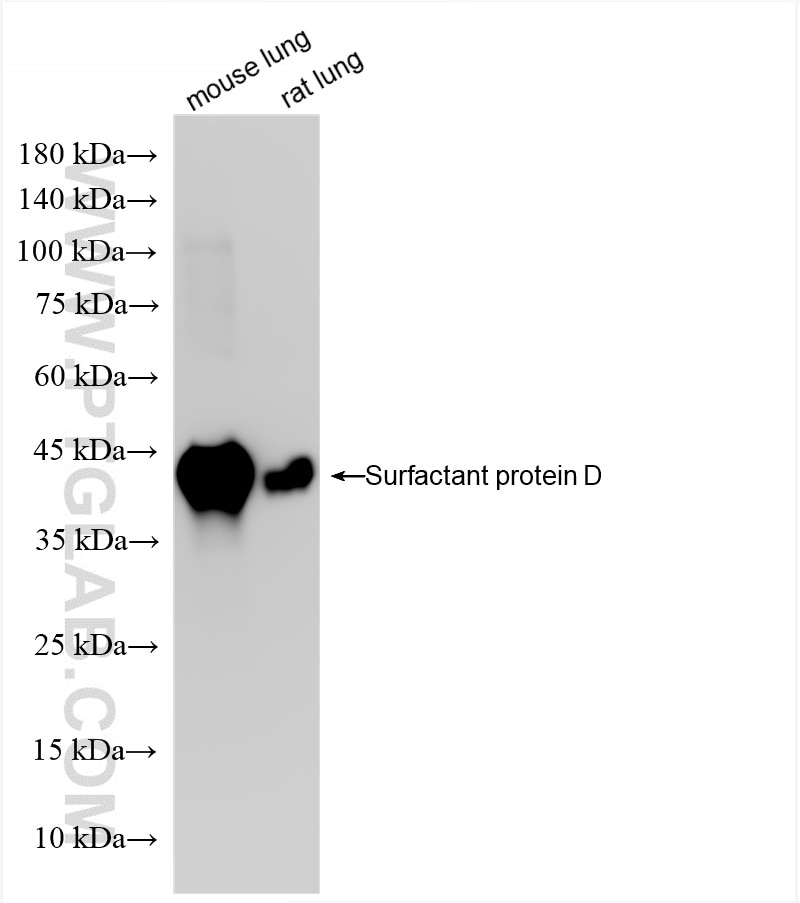 Western Blot (WB) analysis of various lysates using Surfactant protein D Recombinant antibody (85985-1-RR)