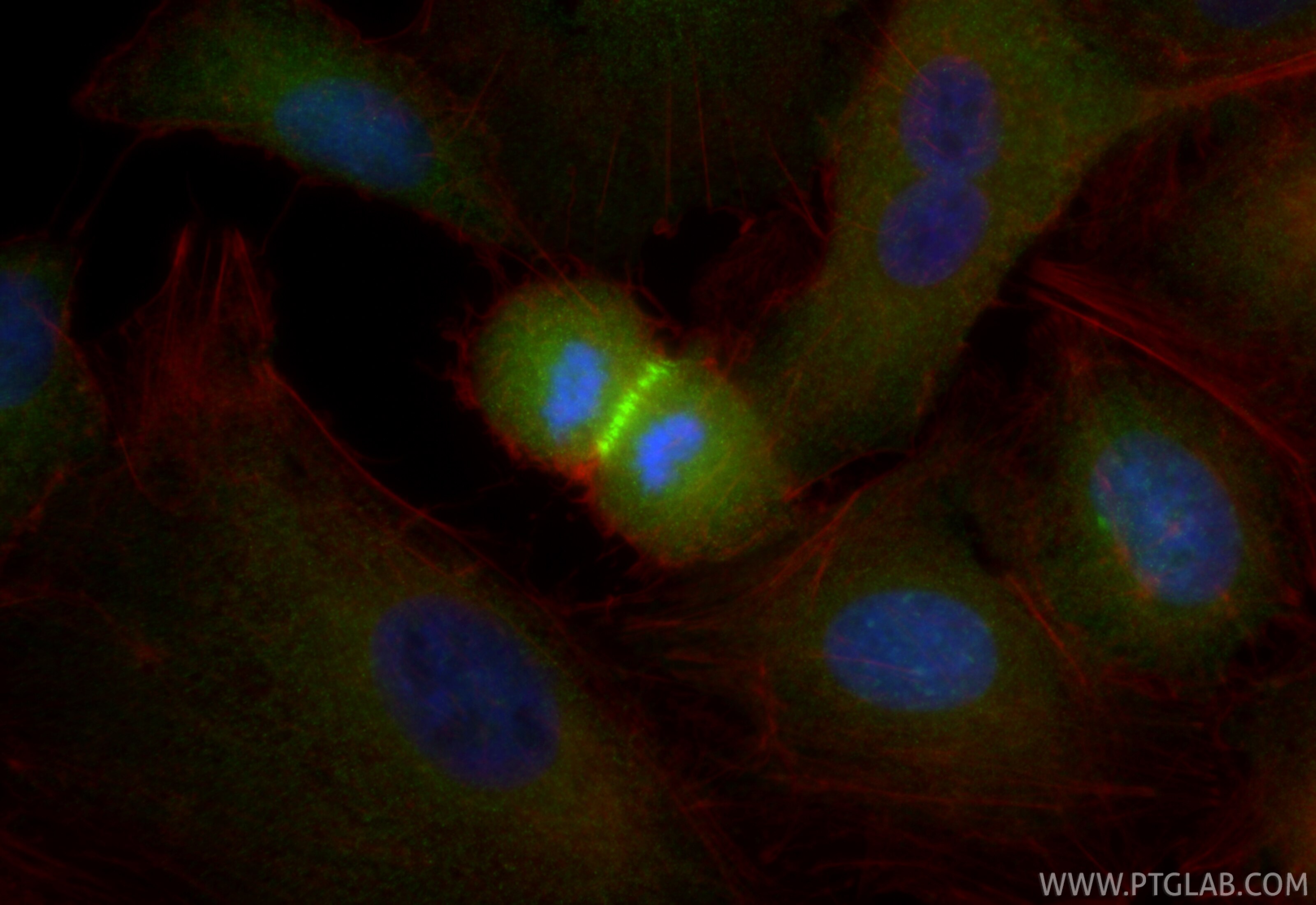 Immunofluorescence (IF) / fluorescent staining of A549 cells using Anti-Human Survivin Rabbit Recombinant Antibody (98624-1-RR)