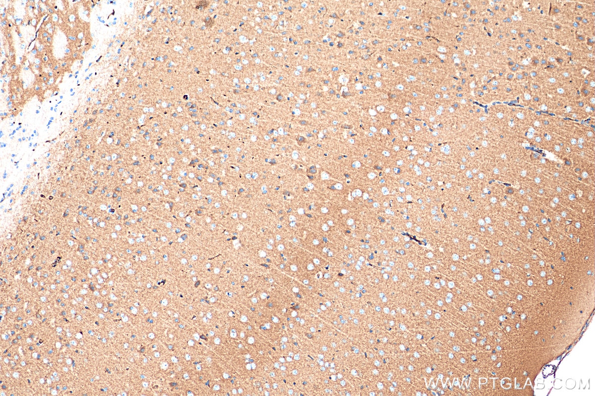 IHC staining of mouse brain using 29734-1-AP