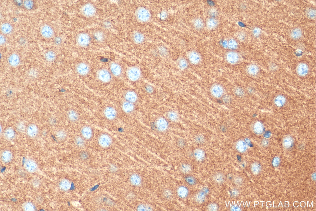 Immunohistochemistry (IHC) staining of mouse brain tissue using Synaptogyrin 1 Polyclonal antibody (29734-1-AP)