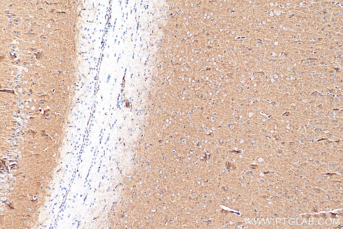 IHC staining of rat brain using 29734-1-AP