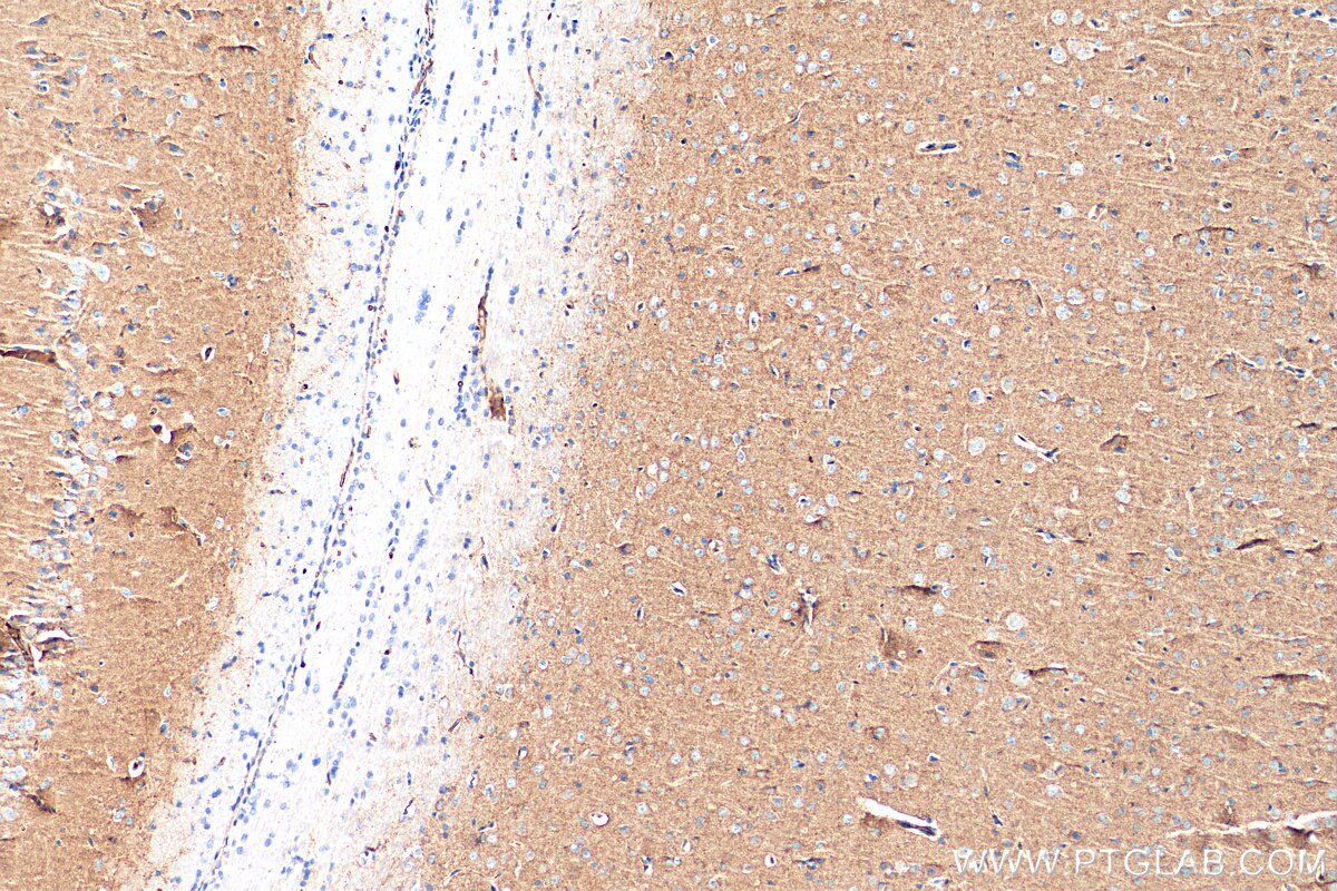 Immunohistochemistry (IHC) staining of rat brain tissue using SYNGR1 Polyclonal antibody (29734-1-AP)