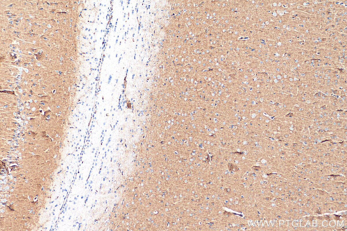 Immunohistochemistry (IHC) staining of rat brain tissue using Synaptogyrin 1 Polyclonal antibody (29734-1-AP)