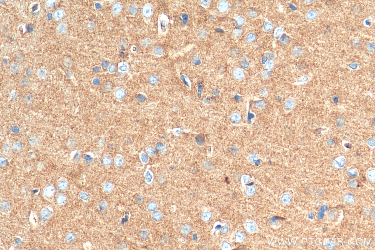 Immunohistochemistry (IHC) staining of rat brain tissue using Synaptogyrin 1 Polyclonal antibody (29734-1-AP)