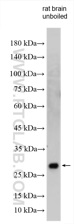 Western Blot (WB) analysis of various lysates using Synaptogyrin 1 Polyclonal antibody (29734-1-AP)