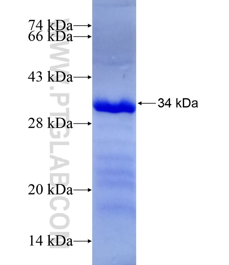 Synaptophysin; SYP fusion protein Ag11803 SDS-PAGE