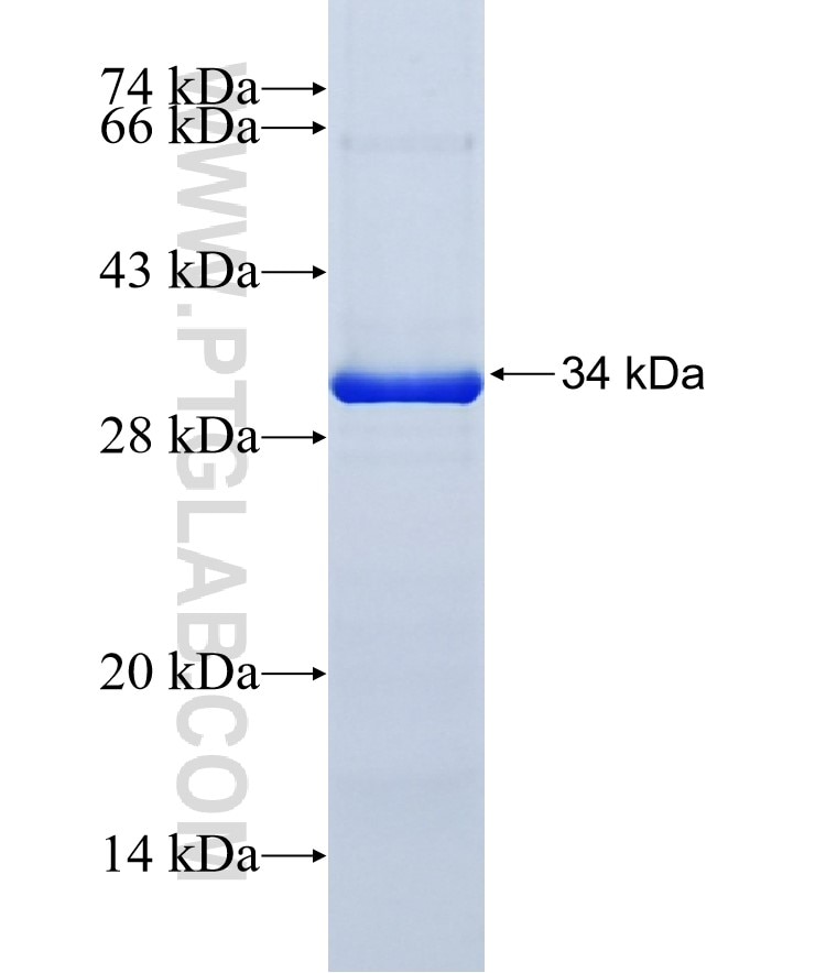 Synaptophysin; SYP fusion protein Ag11803 SDS-PAGE