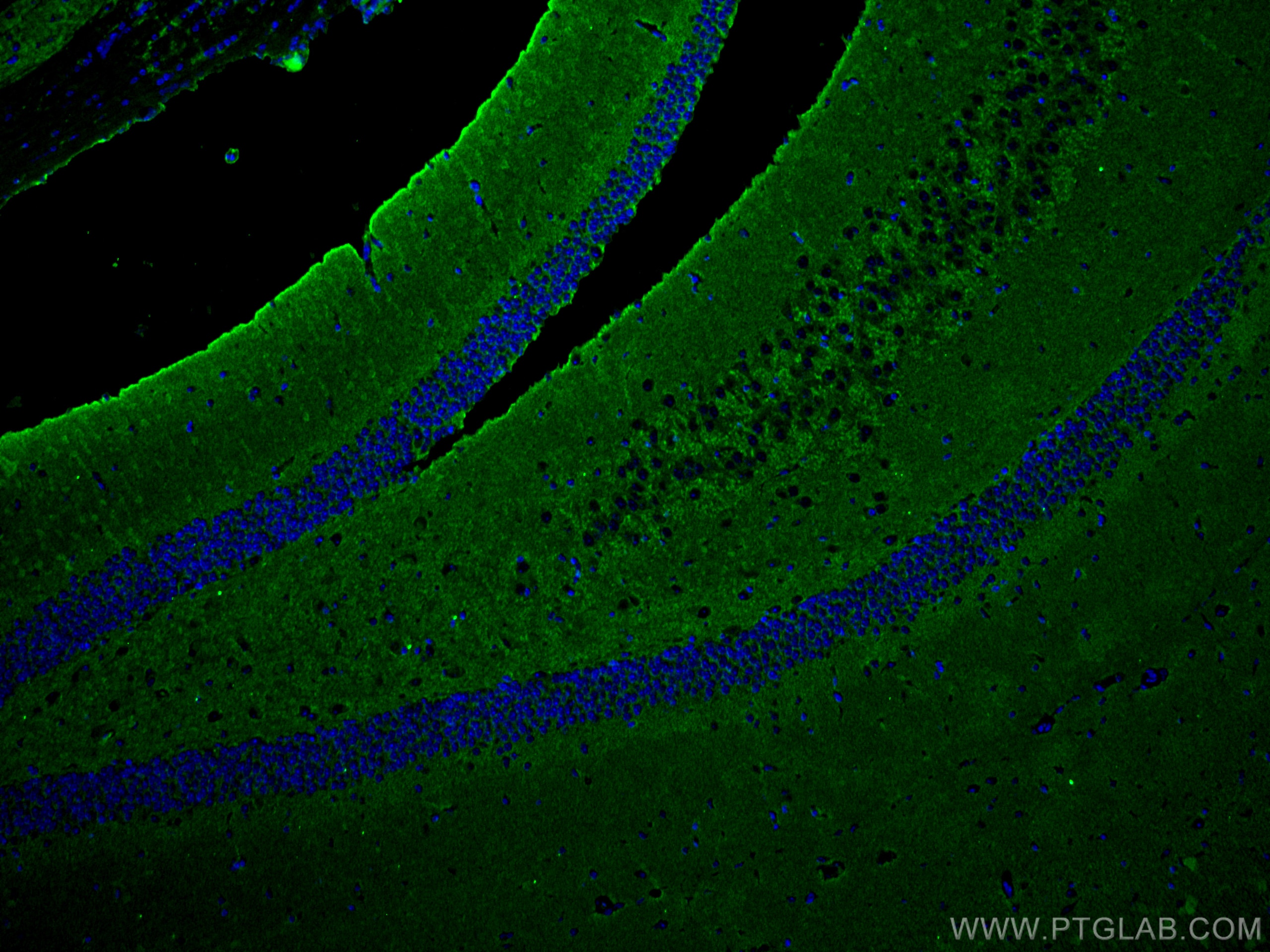 Synaptophysin