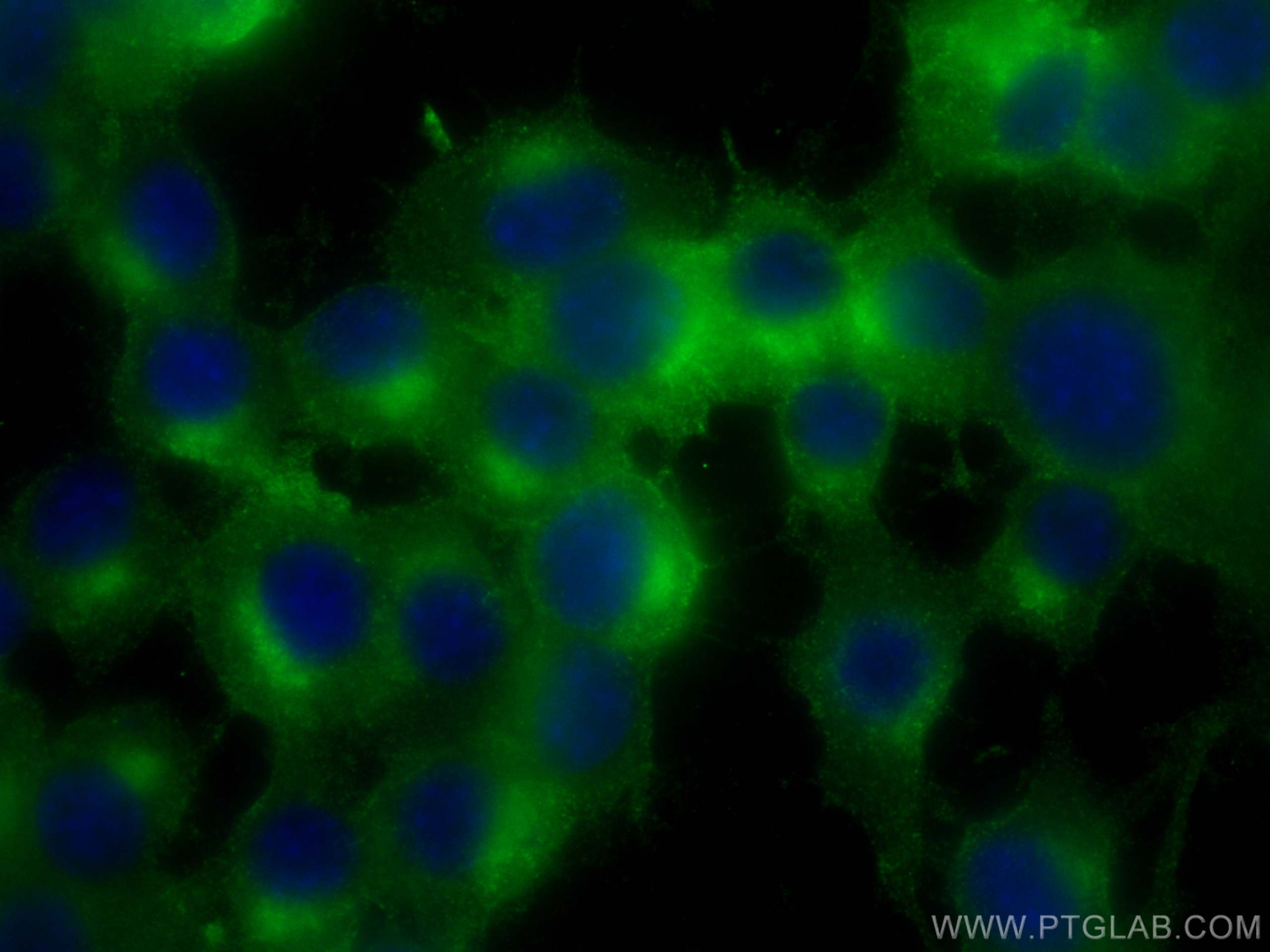 Immunofluorescence (IF) / fluorescent staining of Neuro-2a cells using Synaptophysin Monoclonal antibody (67864-1-Ig)